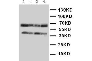 Western Blotting (WB) image for anti-Chemokine (C-C Motif) Receptor 5 (CCR5) (AA 19-34), (N-Term) antibody (ABIN3044318)
