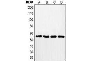 Western blot analysis of RAD18 expression in MCF7 (A), A549 (B), Jurkat (C), HCT116 (D) whole cell lysates. (RAD18 抗体  (Center))