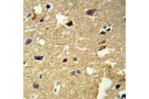 IHC analysis of FFPE human brain tissue stained with anti-beta Tubulin antibody (TUBB1 抗体)
