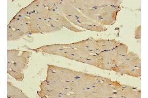 Immunohistochemistry (IHC) image for anti-Solute Carrier Family 16, Member 10 (Aromatic Amino Acid Transporter) (SLC16A10) (AA 159-201) antibody (ABIN7160153)