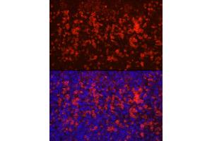 anti-CD4 (CD4) (AA 300-400) antibody