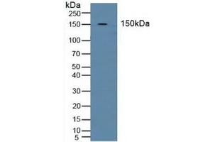 Western Blotting (WB) image for anti-Solute Carrier Family 4, Anion Exchanger, Member 1 (erythrocyte Membrane Protein Band 3, Diego Blood Group) (SLC4A1) (AA 35-290) antibody (ABIN7441895)