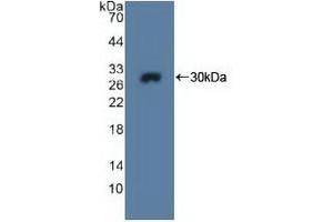 Detection of Recombinant MPG, Human using Polyclonal Antibody to N-Methylpurine DNA Glycosylase (MPG) (MPG 抗体  (AA 221-296))