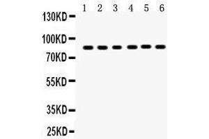 Anti-TPA Picoband antibody, Western blotting All lanes: Anti TPA  at 0. (PLAT 抗体  (AA 366-562))