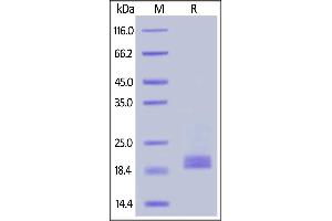 Biotinylated Cynomolgus CD3E&CD3D Heterodimer Protein, His,Avitag™&Tag Free on  under reducing (R) condition.