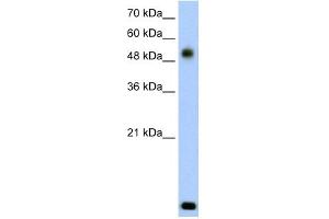 WB Suggested Anti-RSAD2 Antibody Titration:  2. (RSAD2 抗体  (N-Term))