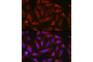 Immunofluorescence analysis of U-2 OS cells using ErbB4/HER4 Rabbit pAb (ABIN6131263, ABIN6140257, ABIN6140260 and ABIN6221732) at dilution of 1:100 (40x lens). (ERBB4 抗体  (AA 26-160))