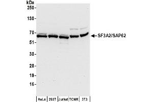 Western Blotting (WB) image for anti-Splicing Factor 3a, Subunit 2, 66kDa (SF3A2) (AA 1-50) antibody (ABIN7449918)
