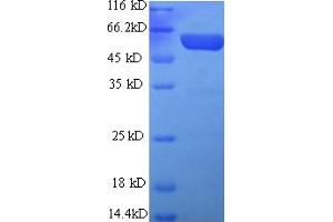 SDS-PAGE (SDS) image for Glial Fibrillary Acidic Protein (GFAP) (AA 1-430), (full length) protein (His-SUMO Tag) (ABIN5709571)