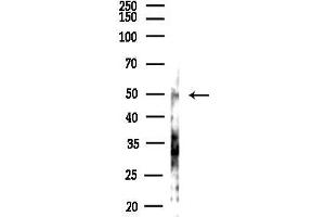 Western blot analysis of lysates from Hela cells(heat-shock,45 min treatment), using PIAS4 Antibody at 1/1000 dilution.