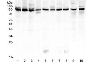 Western blot testing of human 1) K562, 2) HeLa, 3) 293T, 4) A431, 5) Caco-2, 6) PC-3, 7) MCF7, 8) U-2 OS, 9) rat testis and 10) mouse testis lysate with Bub1 antibody at 0. (BUB1 抗体  (AA 731-1085))