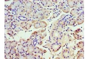 Immunohistochemistry of paraffin-embedded human pancreatic tissue using ABIN7142031 at dilution of 1:100 (ABHD5 抗体  (AA 1-349))