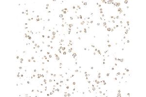 Immunocytochemistry (ICC) image for anti-Ectonucleoside Triphosphate diphosphohydrolase 1 (ENTPD1) (AA 300-350) antibody (ABIN7795686) (Recombinant CD39 抗体  (AA 300-350))