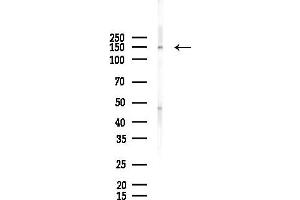 anti-Xin Actin-Binding Repeat Containing 1 (XIRP1) antibody