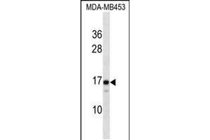 Western blot analysis in MDA-MB453 cell line lysates (35ug/lane). (LIM2 抗体  (C-Term))
