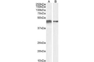 Western Blotting (WB) image for anti-Actin, alpha 2, Smooth Muscle, Aorta (ACTA2) (N-Term) antibody (ABIN185271)