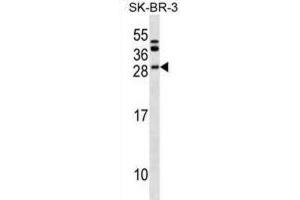 Western Blotting (WB) image for anti-B-Cell CLL/lymphoma 7C (BCL7C) antibody (ABIN2999905) (BCL7C 抗体)