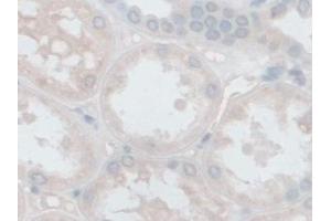 Immunohistochemistry (IHC) image for anti-Follistatin-Like 1 (FSTL1) (AA 21-308) antibody (ABIN7436609)
