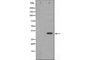 Western blot analysis of DARPP-32 expression in EGF treated 293 whole cell lysates,The lane on the left is treated with the antigen-specific peptide. (DARPP32 抗体)