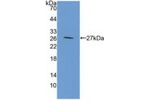 Detection of Recombinant GP39, Mouse using Polyclonal Antibody to Chitinase-3-like Protein 1 (CHI3L1) (CHI3L1 抗体  (AA 112-356))