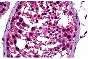 Human Testis: Formalin-Fixed, Paraffin-Embedded (FFPE) (NEUROD1 抗体  (AA 201-300))