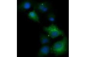 Image no. 13 for anti-Tripartite Motif Containing 38 (TRIM38) (AA 1-265) antibody (ABIN1490681)