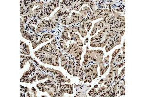 IHC analysis of HNRNPL using anti-HNRNPL antibody (ABIN4886624).