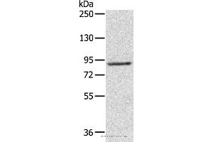 Western blot analysis of 231 cell, using RPS6KA1 Polyclonal Antibody at dilution of 1:800 (RPS6KA1 抗体)