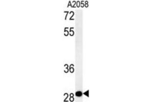 Western Blotting (WB) image for anti-Chromosome 11 Open Reading Frame 46 (C11orf46) antibody (ABIN2995509) (C11orf46 抗体)