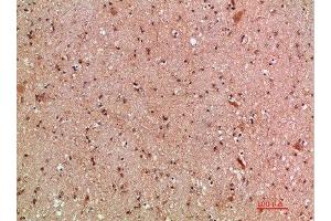 Immunohistochemical analysis of paraffin-embedded human-brain, antibody was diluted at 1:200