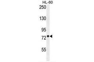 CPT1C Antibody (C-term) western blot analysis in HL-60 cell line lysates (35µg/lane). (CPT1C 抗体  (C-Term))
