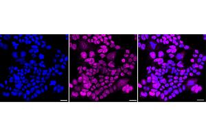 Immunocytochemical staining of HAP-1 cells with GATA2/3 antibody (ABIN7800933), 1:1,000). (Recombinant GATA2/GATA3 抗体)