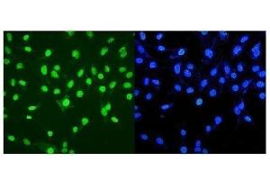 IF analysis of MTA2 using anti-MTA2 antibody (ABIN7599519). (MTA2 抗体  (AA 1-668))