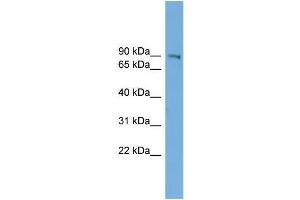 Human HepG2; WB Suggested Anti-UTP14A Antibody Titration: 0. (UTP14A 抗体  (N-Term))