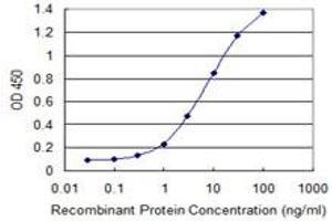 Detection limit for recombinant GST tagged HSFY1 is 0. (HSFY1 抗体  (AA 1-99))