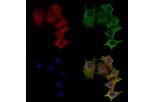ABIN6259067 and ABIN6273445 staining HepG2 cells by IF/ICC.