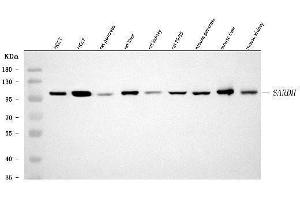 Western blot analysis of SARDH using anti-SARDH antibody (ABIN7599510).