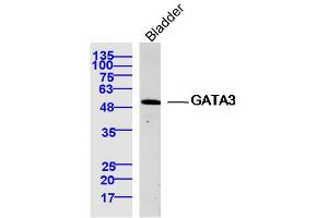 Mouse bladder lysates probed with GATA3 Polyclonal Antibody, Unconjugated  at 1:300 dilution and 4˚C overnight incubation. (GATA3 抗体  (AA 151-250))