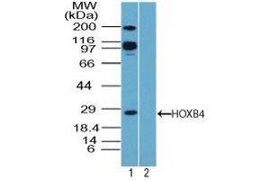 Image no. 1 for anti-Homeobox B4 (HOXB4) (AA 100-150) antibody (ABIN960213) (HOXB4 抗体  (AA 100-150))