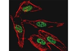 Fluorescent confocal image of HeLa cell stained with MyoD1 antibody at 1:25. (MYOD1 抗体  (AA 211-240))