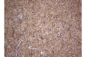 Image no. 3 for anti-Neurofilament, Light Polypeptide (NEFL) (AA 1-360) antibody (ABIN1490762)