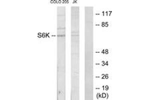 Western blot analysis of extracts from COLO205/Jurkat cells, using S6K Antibody. (RPS6KB1 抗体  (AA 261-310))