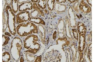 ABIN6279082 at 1/100 staining Mouse kidney tissue by IHC-P. (ADAMTS1 抗体  (Internal Region))