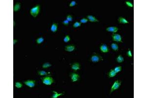 Immunofluorescence (IF) image for anti-Collagen, Type VIII, alpha 1 (COL8A1) (AA 572-744) antibody (ABIN7148217)