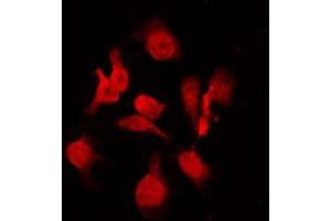 ABIN6269025 staining sw480 by IF/ICC. (KRT16 抗体  (C-Term))