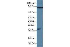 Detection of CAMK2g in Rat Cerebrum lysate using Polyclonal Antibody to Calcium/Calmodulin Dependent Protein Kinase II Gamma (CAMK2g) (CAMKII gamma 抗体  (AA 6-208))