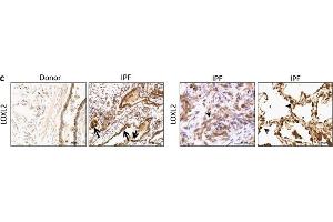 Immunohistochemistry (Paraffin-embedded Sections) (IHC (p)) image for anti-Lysyl Oxidase-Like 2 (LOXL2) antibody (ABIN2856034)