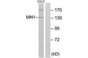 Western blot analysis of extracts from COLO cells, using MN1 Antibody. (Meningioma 1 抗体  (AA 821-870))