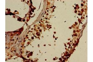 Immunohistochemistry of paraffin-embedded human testis tissue using ABIN7151564 at dilution of 1:100 (ELOVL4 抗体  (AA 270-314))