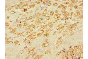 Immunohistochemistry of paraffin-embedded human placental tissue using ABIN7150164 at dilution of 1:100 (Retinoblastoma Binding Protein 8 抗体  (AA 126-331))